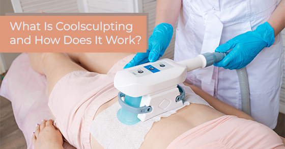 What is coolsculpting and how does it work?