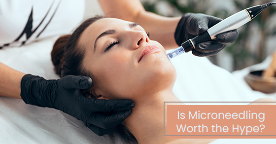 Is microneedling worth the hype?