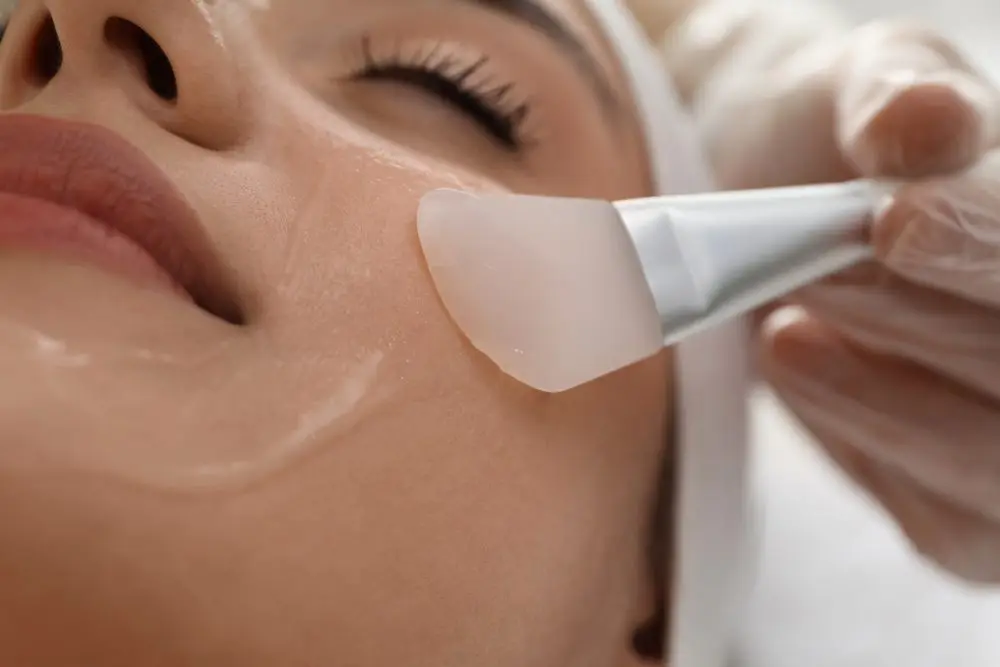 Chemical peel treatment being applied at Skin6 Toronto